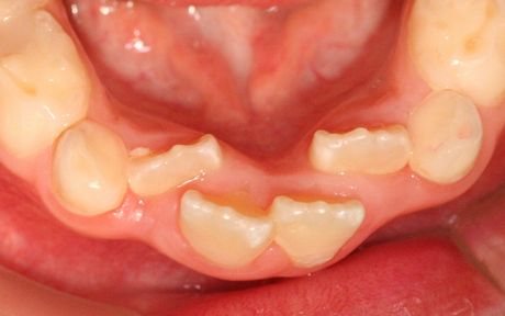 「しばらく様子を見ましょう」とは？